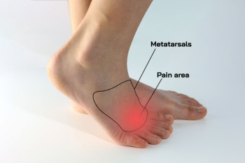 Nerve pain in soles of feet deals