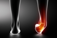 How Do Ankle Sprains Occur?